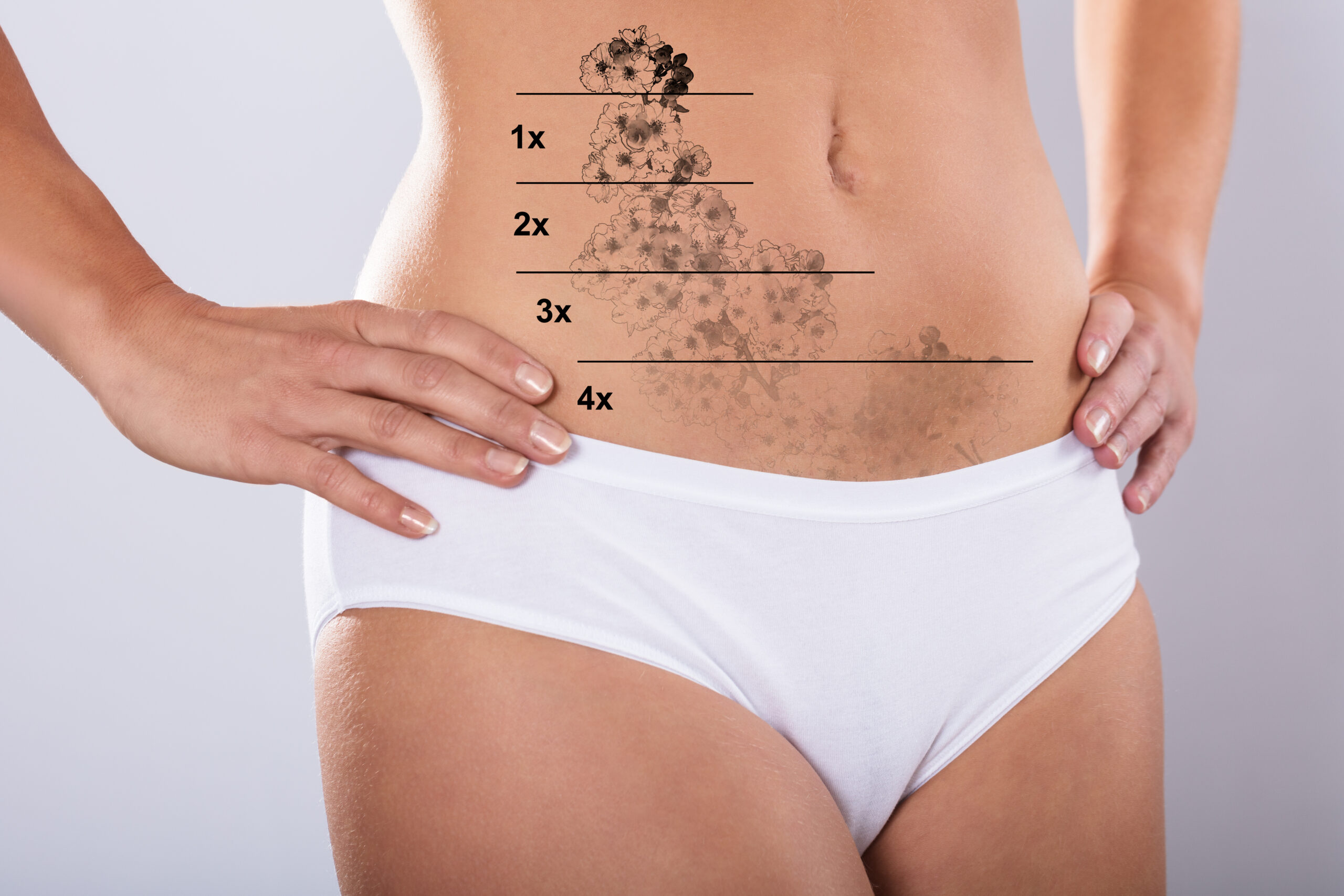 Achieve a Clean Slate for Your Skin with Laser Tattoo Removal